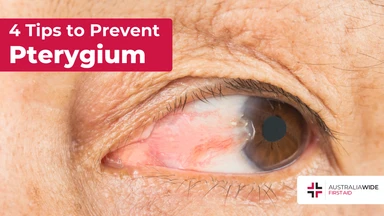 Prevent pterygium article header – First Aid Course Laverton Prevent pterygium article header – First Aid Article in Laverton